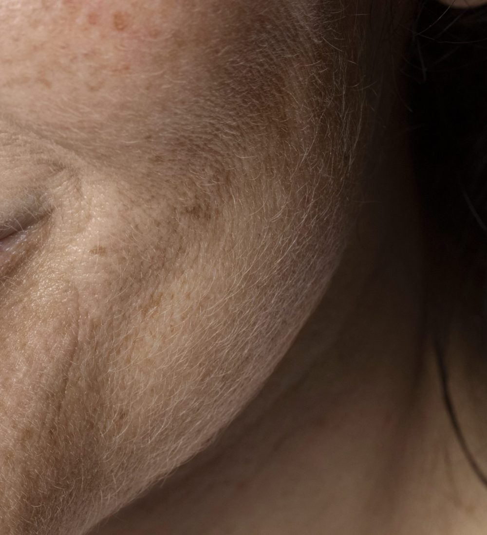 close-up-face-pores-texture